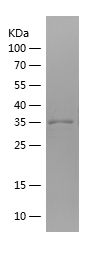    GLS / Recombinant Human GLS