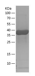    CAB39L / Recombinant Human CAB39L