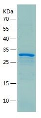    GLUT1 / Recombinant Human GLUT1