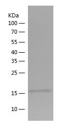    MYL9 / Recombinant Human MYL9