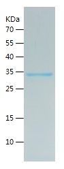    SIRT1 / Recombinant Human SIRT1