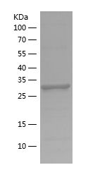    LDHA / Recombinant Human LDHA