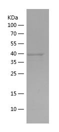    Actc1 / Recombinant Human Actc1