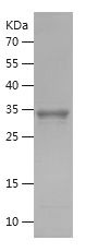    ALPL / Recombinant Human ALPL