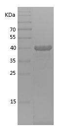    ARPC5L / Recombinant Human ARPC5L