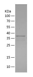    SERPINA1 / Recombinant Human SERPINA1