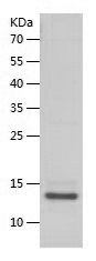    B2M / Recombinant Human B2M