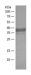    CALB2 / Recombinant Human CALB2