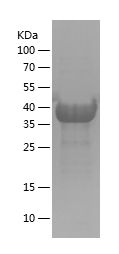    BNIP3L / Recombinant Human BNIP3L