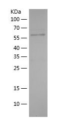    ABCF2 / Recombinant Human ABCF2