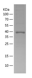    CAMK2D / Recombinant Human CAMK2D