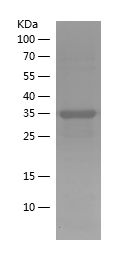    ACVR1B / Recombinant Human ACVR1B