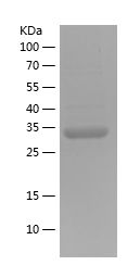    GLA / Recombinant Human GLA