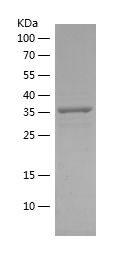    ACOX1 / Recombinant Human ACOX1