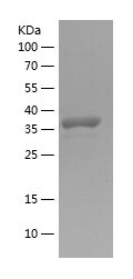    ANGPTL2 / Recombinant Human ANGPTL2