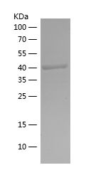    CAT / Recombinant Human CAT