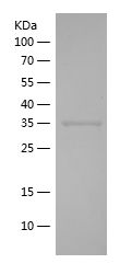    APEX1 / Recombinant Human APEX1