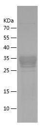    AR / Recombinant Human AR