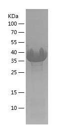    AGR2 / Recombinant Human AGR2