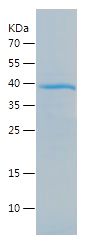    CTCFL / Recombinant Human CTCFL