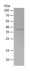    AKT2 / Recombinant Human AKT2