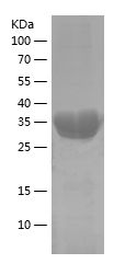    C6 / Recombinant Human C6