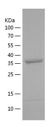    SERPINF2 / Recombinant Human SERPINF2