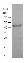    CA9 / Recombinant Human CA9