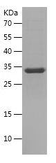    CD11A / Recombinant Human CD11A