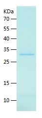    ATXN2 / Recombinant Human ATXN2