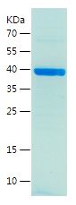    ADCY3 / Recombinant Human ADCY3