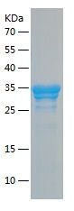    AEG-1 / Recombinant Human AEG-1