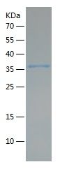    CD206 / Recombinant Human CD206