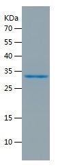    COX-1 / Recombinant Human COX-1