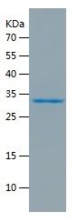    COX-1 / Recombinant Human COX-1