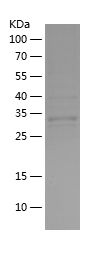    RSK2 / Recombinant Human RSK2