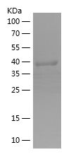    APPL1 / Recombinant Human APPL1