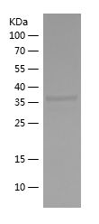    AGER / Recombinant Human AGER