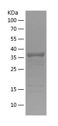    CD246 / Recombinant Human CD246