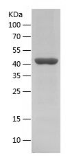    ATXN3L / Recombinant Human ATXN3L