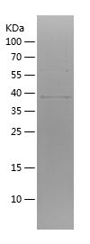    ATP5F1A / Recombinant Human ATP5F1A