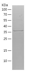    Autotaxin / Recombinant Human Autotaxin