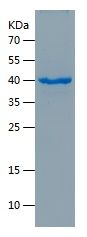    GREM1 / Recombinant Human GREM1