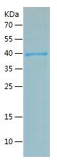    BRCA2 / Recombinant Human BRCA2