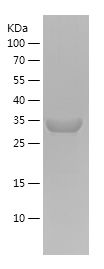    ACTA1 / Recombinant Human ACTA1