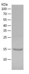    FABP1 / Recombinant Human FABP1