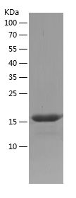    CABYR / Recombinant Human CABYR