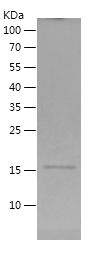    METTL18 / Recombinant Human METTL18