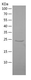    DYRK4 / Recombinant Human DYRK4