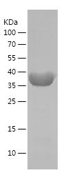    DDX25 / Recombinant Human DDX25